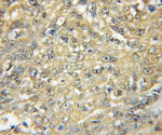 HCK Antibody in Immunohistochemistry (Paraffin) (IHC (P))