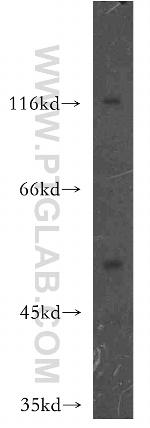 HCK Antibody in Western Blot (WB)