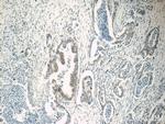 IGF2BP2 Antibody in Immunohistochemistry (Paraffin) (IHC (P))