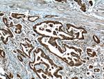 IGF2BP2 Antibody in Immunohistochemistry (Paraffin) (IHC (P))