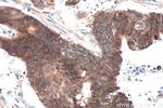 IGF2BP2 Antibody in Immunohistochemistry (Paraffin) (IHC (P))