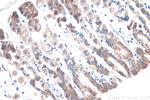 IGF2BP2 Antibody in Immunohistochemistry (Paraffin) (IHC (P))