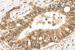 IGF2BP2 Antibody in Immunohistochemistry (Paraffin) (IHC (P))