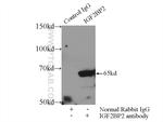 IGF2BP2 Antibody in Immunoprecipitation (IP)