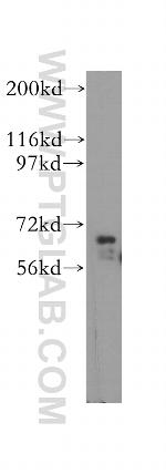 IGF2BP2 Antibody in Western Blot (WB)