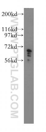 IGF2BP2 Antibody in Western Blot (WB)