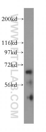 IGF2BP2 Antibody in Western Blot (WB)