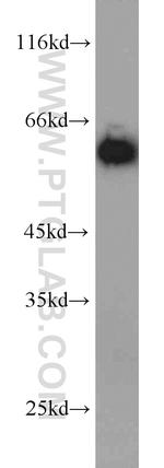 CCT5 Antibody in Western Blot (WB)