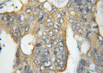 CCT5 Antibody in Immunohistochemistry (Paraffin) (IHC (P))