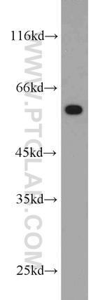 CCT5 Antibody in Western Blot (WB)