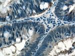 CCT5 Antibody in Immunohistochemistry (Paraffin) (IHC (P))