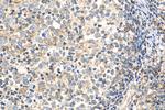 Cyclophilin B Antibody in Immunohistochemistry (Paraffin) (IHC (P))