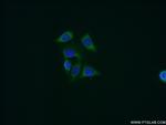 Cyclophilin B Antibody in Immunocytochemistry (ICC/IF)