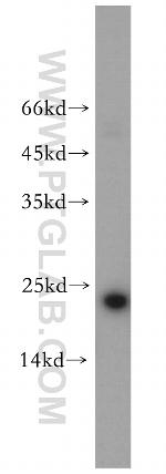 Cyclophilin B Antibody in Western Blot (WB)