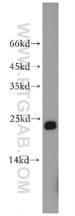 Cyclophilin B Antibody in Western Blot (WB)