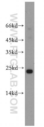 Cyclophilin B Antibody in Western Blot (WB)