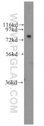 CPSF3 Antibody in Western Blot (WB)