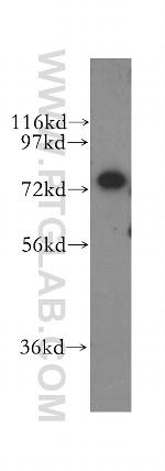 CPSF3 Antibody in Western Blot (WB)