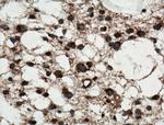 MTX2 Antibody in Immunohistochemistry (Paraffin) (IHC (P))