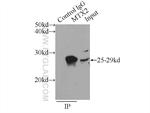 MTX2 Antibody in Immunoprecipitation (IP)