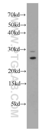 MTX2 Antibody in Western Blot (WB)