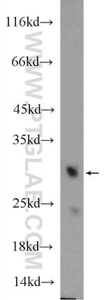 MTX2 Antibody in Western Blot (WB)