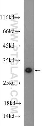 MTX2 Antibody in Western Blot (WB)