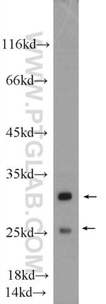 MTX2 Antibody in Western Blot (WB)