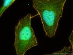 VPRBP Antibody in Immunocytochemistry (ICC/IF)