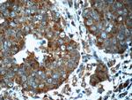 VPRBP Antibody in Immunohistochemistry (Paraffin) (IHC (P))