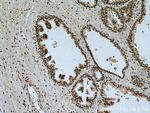 VPRBP Antibody in Immunohistochemistry (Paraffin) (IHC (P))