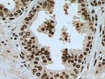 VPRBP Antibody in Immunohistochemistry (Paraffin) (IHC (P))