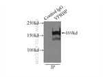 VPRBP Antibody in Immunoprecipitation (IP)