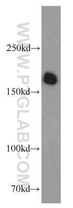 VPRBP Antibody in Western Blot (WB)