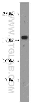 VPRBP Antibody in Western Blot (WB)