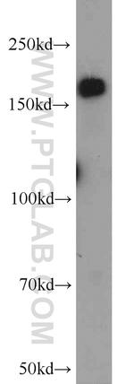 VPRBP Antibody in Western Blot (WB)