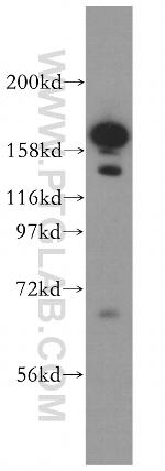 VPRBP Antibody in Western Blot (WB)