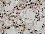 BCL11A Antibody in Immunohistochemistry (Paraffin) (IHC (P))