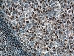 BCL11A Antibody in Immunohistochemistry (Paraffin) (IHC (P))