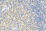 BCL11A Antibody in Immunohistochemistry (Paraffin) (IHC (P))