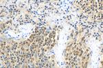 BCL11A Antibody in Immunohistochemistry (Paraffin) (IHC (P))