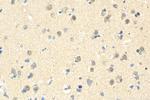 BCL11A Antibody in Immunohistochemistry (Paraffin) (IHC (P))