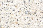 BCL11A Antibody in Immunohistochemistry (Paraffin) (IHC (P))