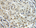 RBM4 Antibody in Immunohistochemistry (Paraffin) (IHC (P))