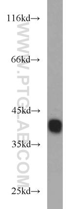 RBM4 Antibody in Western Blot (WB)