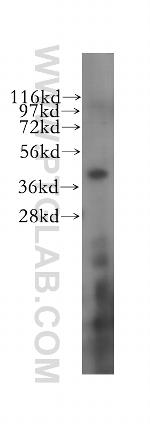 RBM4 Antibody in Western Blot (WB)