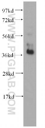 RBM4 Antibody in Western Blot (WB)