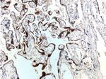 hCG beta Antibody in Immunohistochemistry (Paraffin) (IHC (P))