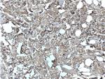 hCG beta Antibody in Immunohistochemistry (Paraffin) (IHC (P))