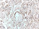 hCG beta Antibody in Immunohistochemistry (Paraffin) (IHC (P))